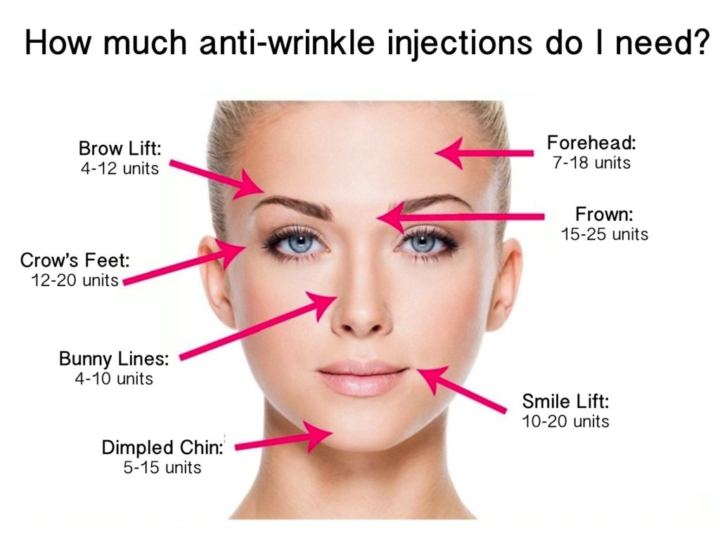 How much anti-wrinkle injections do you need? - Dr Lindsay Moran