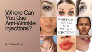 A composite image showing various facial expressions and areas where anti-wrinkle injections can be applied, accompanied by the title "Where Can You Use Anti-Wrinkle Injections?"—a premier wrinkle treatment credited to Dr. Lindsay Moran.