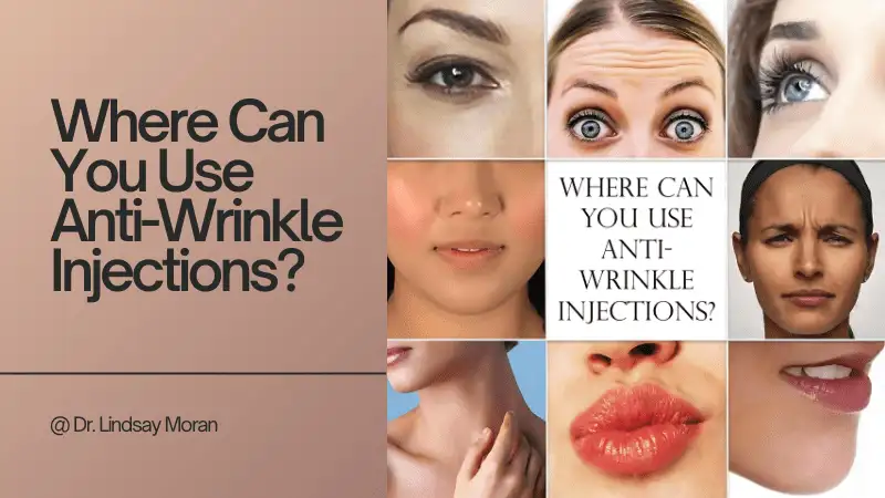 A composite image showing various facial expressions and areas where anti-wrinkle injections can be applied, accompanied by the title "Where Can You Use Anti-Wrinkle Injections?"—a premier wrinkle treatment credited to Dr. Lindsay Moran.