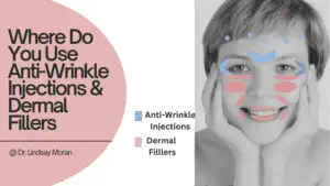 A grayscale image of a person's face with colored areas highlighting where anti-wrinkle injections (blue) and dermal fillers (red) are applied. Text: "Where Do You Use Anti-Wrinkle Injections & Dermal Fillers @ Dr. Lindsay Moran?" Discover the ultimate anti-aging treatment today!