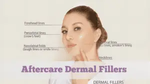 Close-up of a woman's face with labels indicating areas enhanced by dermal fillers: forehead lines, periorbital lines, nasolabial folds, perioral lines, and necklines. Text reads "Aftercare for Dermal Fillers.