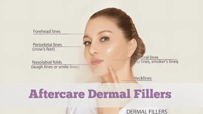 Close-up of a woman's face with labels indicating areas enhanced by dermal fillers: forehead lines, periorbital lines, nasolabial folds, perioral lines, and necklines. Text reads "Aftercare for Dermal Fillers.