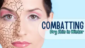 Close-up of a woman's face partially showing dry, cracked skin. Text reads "Winter Skincare: Combatting Dry Skin" on a blue background.