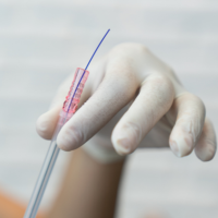 A woman's hand holding a syringe filled with medicine for treatments.
